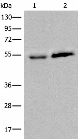 Western blot analysis of Human fetal intestines tissue and Human breast cancer tissue lysates using CCDC85C Polyclonal Antibody at dilution of 1:400