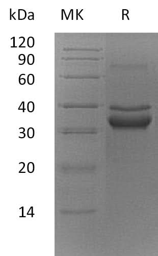 Recombinant Mouse FN14/TWEAKR Protein (Fc Tag) - ABMIUM
