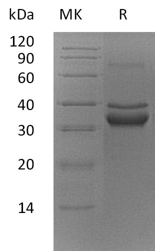 Recombinant Mouse FN14/TWEAKR Protein (Fc Tag) - ABMIUM