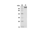 SDS-PAGE analysis of Mouse gp130 proteins, 2 μg/lane of Recombinant Mouse gp130 proteins was resolved with SDS-PAGE under reducing conditions, showing bands at 90-100 kDa.