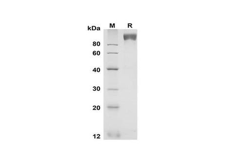 SDS-PAGE analysis of Mouse gp130 proteins, 2 μg/lane of Recombinant Mouse gp130 proteins was resolved with SDS-PAGE under reducing conditions, showing bands at 90-100 kDa.