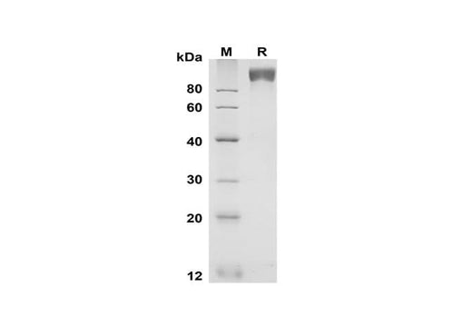SDS-PAGE analysis of Mouse gp130 proteins, 2 μg/lane of Recombinant Mouse gp130 proteins was resolved with SDS-PAGE under reducing conditions, showing bands at 90-100 kDa.