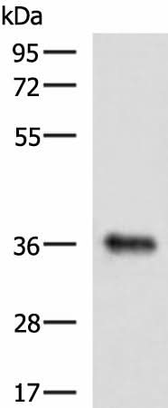 Western blot analysis of Mouse liver tissue lysate using GRHPR Polyclonal Antibody at dilution of 1:900