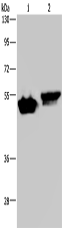 Anti-Human/Mouse AVEN Antibody - ABMIUM