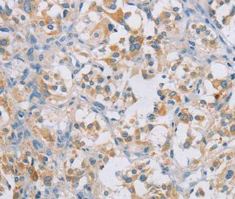 Anti-Human CERKL Antibody