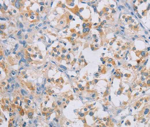 Anti-Human CERKL Antibody