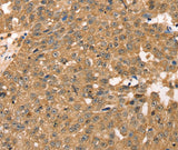 Anti-Human/Mouse/Rat RPLP2 Antibody - ABMIUM