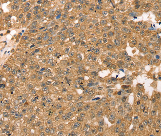 Anti-Human/Mouse/Rat RPLP2 Antibody - ABMIUM
