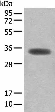 Western blot analysis of Mouse skeletal muscle tissue lysate using MYOZ2 Polyclonal Antibody at dilution of 1:450