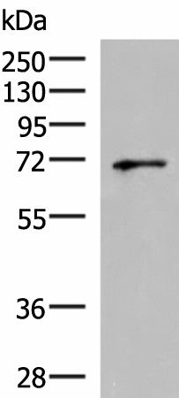 Western blot analysis of PC3 cell lysate using GSPT2 Polyclonal Antibody at dilution of 1:600
