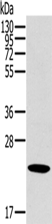Anti-Human/Mouse OTUB2 Antibody - ABMIUM
