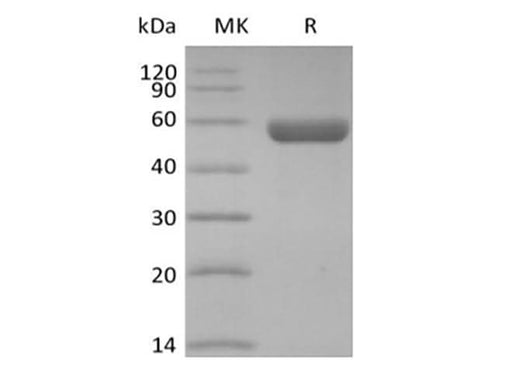 Recombinant Human HLA-A*0201 GP100 complex Protein (C-10His) - ABMIUM