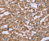 Anti-Human IFNA2 Antibody - ABMIUM