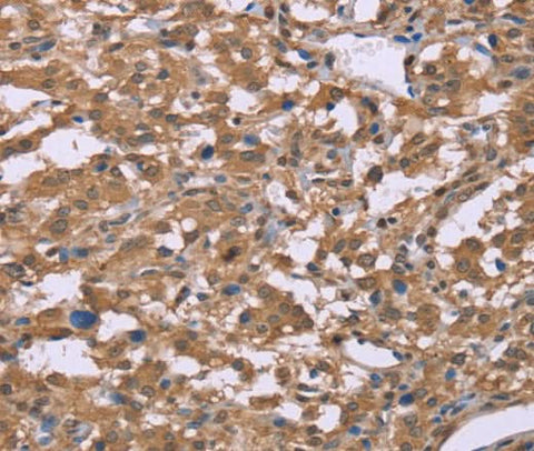 Anti-Human IFNA2 Antibody - ABMIUM