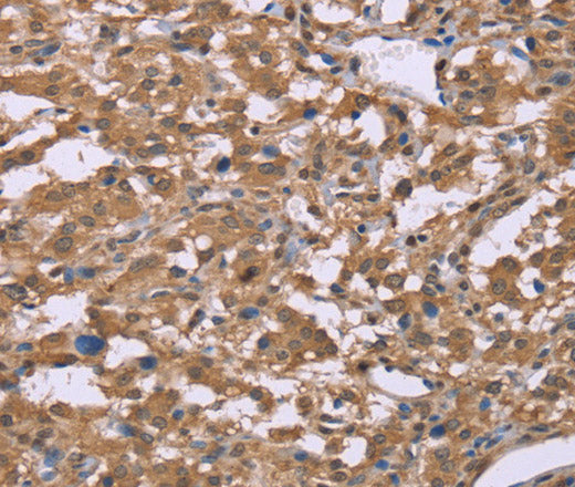Anti-Human IFNA2 Antibody - ABMIUM