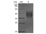Recombinant Cynomolgus VSIR Protein (His Tag) - ABMIUM