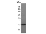 Recombinant Mouse GDNF protein(N-His) - ABMIUM