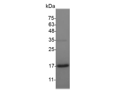 Recombinant Mouse GDNF protein(N-His) - ABMIUM