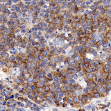 Immunohistochemistry analysis of paraffin-embedded human tonsil using CD192 Polyclonal Antibody at dilution of 1:300.