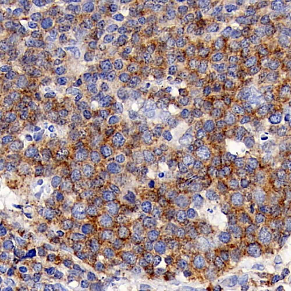 Immunohistochemistry analysis of paraffin-embedded human tonsil using CD192 Polyclonal Antibody at dilution of 1:300.