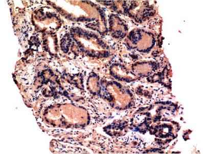 Anti-Human/Mouse/Rat CASP3 Antibody [4B8]