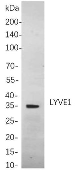 Anti-Human/Mouse/Rat LYVE1 Antibody [B846]