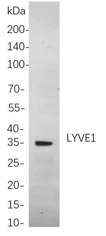 Anti-Human/Mouse/Rat LYVE1 Antibody [B846] - ABMIUM