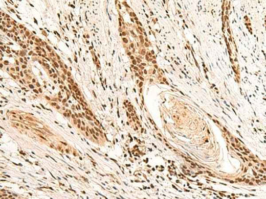 Anti-Human/Mouse RMND5B Antibody