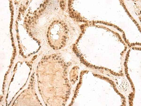 Anti-Human/Mouse MKX Antibody