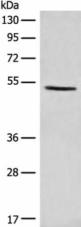 Western blot analysis of NIH/3T3 cell lysate using PTEN Polyclonal Antibody at dilution of 1:1100