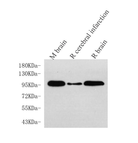 Western Blot analysis of various samples using DLG4 Polyclonal Antibody at dilution of 1:750.