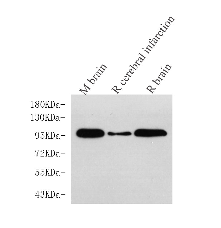 Western Blot analysis of various samples using DLG4 Polyclonal Antibody at dilution of 1:750.