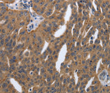 Anti-Human/Mouse/Rat PDGFA Antibody - ABMIUM