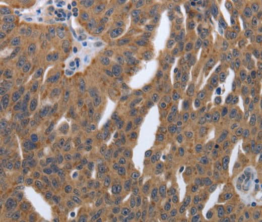 Anti-Human/Mouse/Rat PDGFA Antibody - ABMIUM