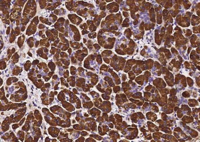 Anti-Human PNLIP Antibody [B188] - ABMIUM