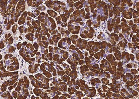 Anti-Human PNLIP Antibody [B188] - ABMIUM