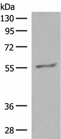 Western blot analysis of Hela cell lysate using GPR161 Polyclonal Antibody at dilution of 1:500
