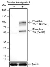 Anti-Human Phospho-YAP1 (Ser127) Antibody [A804] - ABMIUM