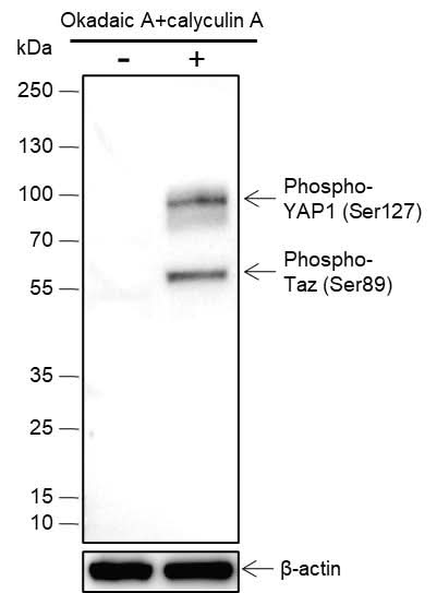 Anti-Human Phospho-YAP1 (Ser127) Antibody [A804] - ABMIUM