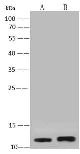 Anti-Human S100A2 Antibody [A944] - ABMIUM