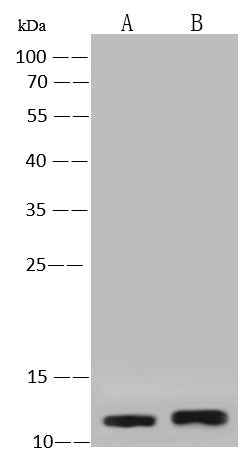Anti-Human S100A2 Antibody [A944] - ABMIUM