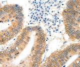 Anti-Human SIPA1 Antibody - ABMIUM