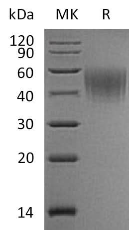 Recombinant Mouse IL2Ra/CD25 Protein (His Tag) - ABMIUM