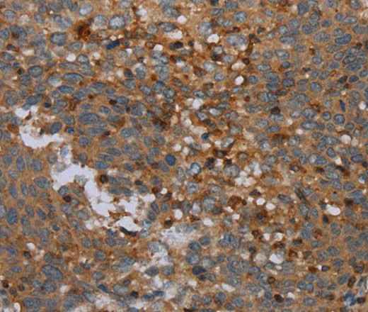 Anti-Human/Mouse OTOR Antibody