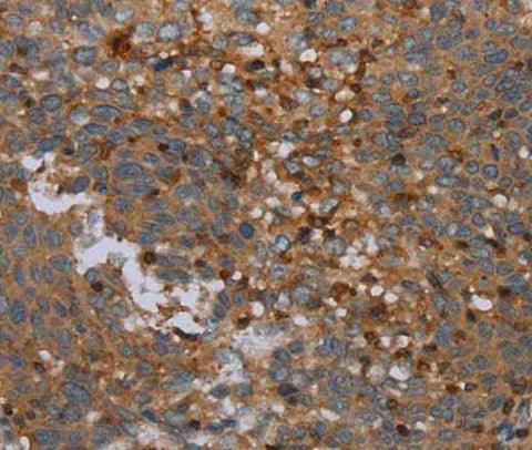 Anti-Human/Mouse OTOR Antibody