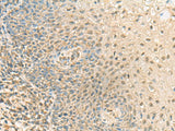 Immunohistochemistry of paraffin-embedded Human tonsil tissue using PPCDC Polyclonal Antibody at dilution of 1:55(×200)