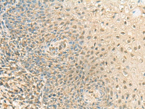 Immunohistochemistry of paraffin-embedded Human tonsil tissue using PPCDC Polyclonal Antibody at dilution of 1:55(×200)