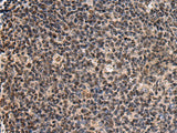 Immunohistochemistry of paraffin-embedded Human tonsil tissue using SIK3 Polyclonal Antibody at dilution of 1:60(×200)