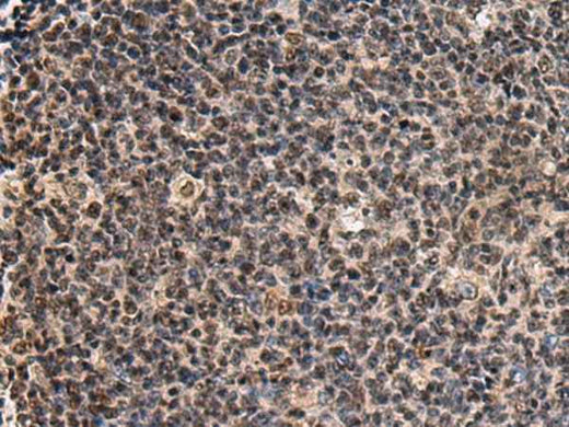 Anti-Human/Mouse SIK3 Antibody