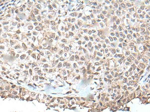 Anti-Human/Mouse UBN1 Antibody